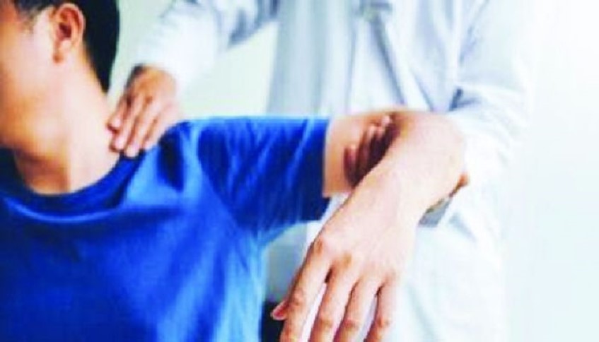 স্ট্রোকে আক্রান্ত রোগীর যে কারণে জরুরি চিকিৎসা দরকার