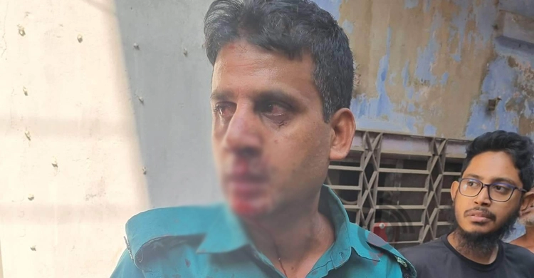জঙ্গি ছিনতাইয়ের ঘটনায় হাসপাতালে ভর্তি আহত কনস্টেবল আজাদ
