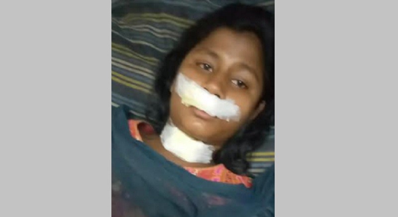 নেত্রকোণায় স্কুলছাত্রীকে ধর্ষণ চেষ্টা, বাধা দেওয়ায় গলা ও ঠোটে ছুরিকাঘাত